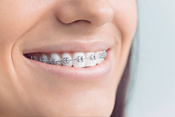 Best Wisdom Tooth Removal  in Cherry Hill Mall, NJ